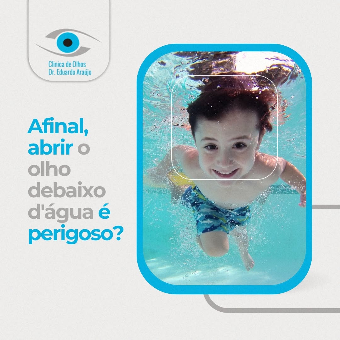 Abrir os olhos debaixo d'água é perigoso?