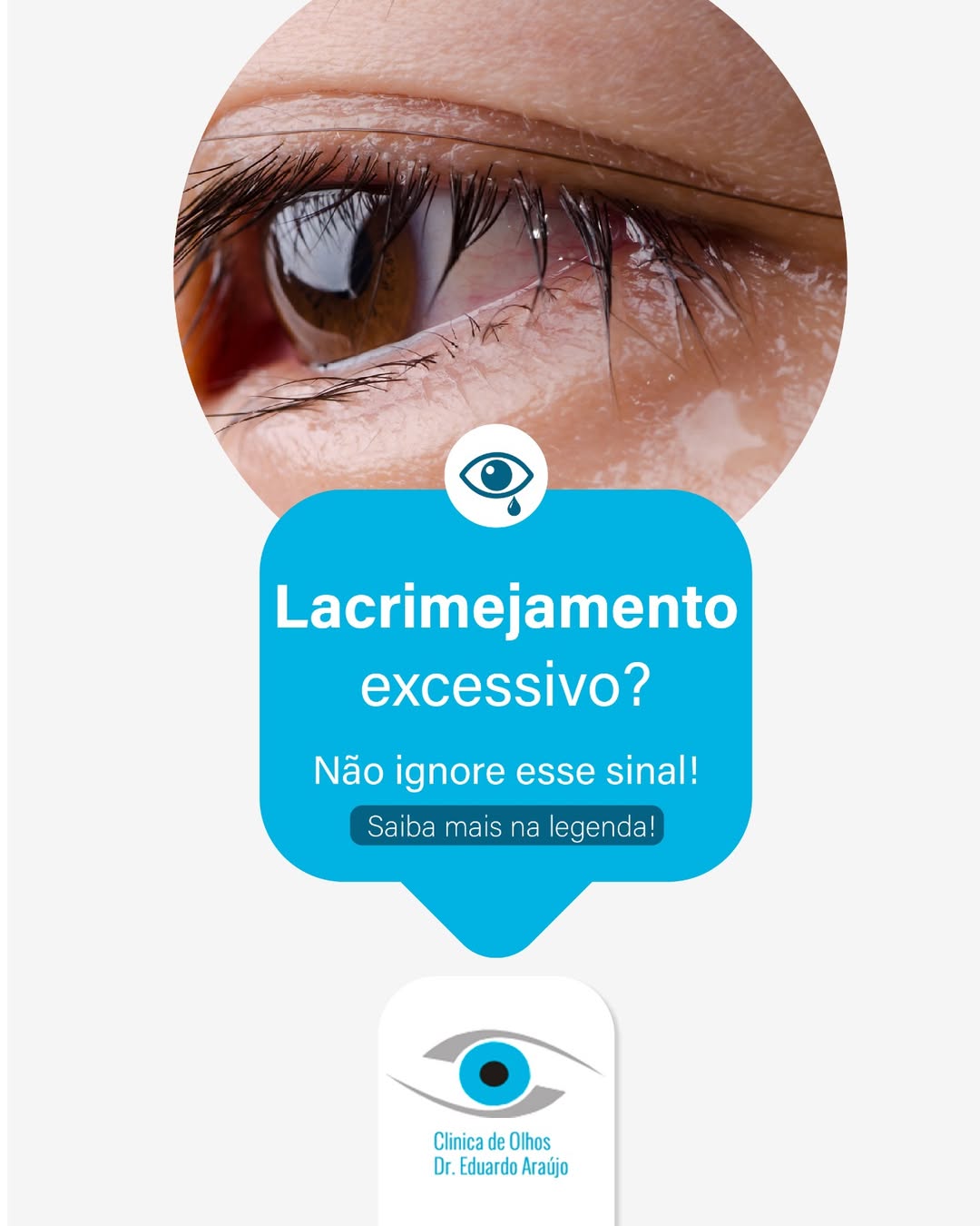 Lacrimejamento excessivo?