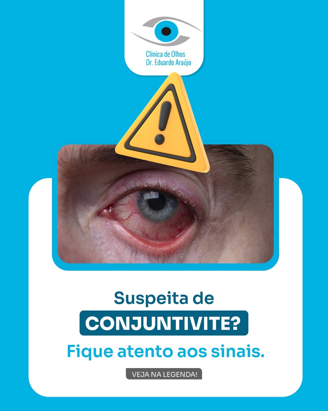 Suspeita de Conjuntivite?